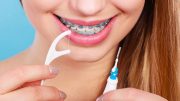 The Proper Way to Floss with Braces