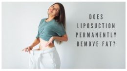 Does Liposuction Permanently Remove Fat